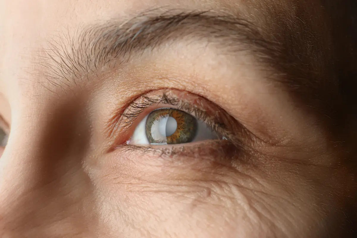 brown eye of senior with cataract